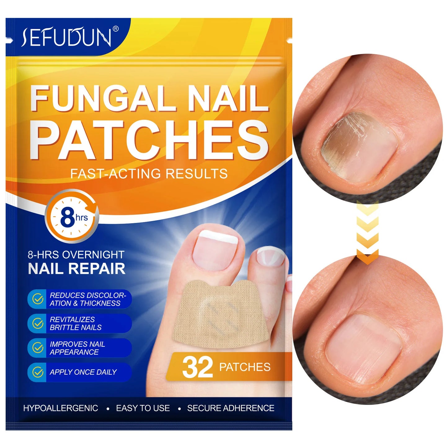 Fungal Nail Repair Patches™ – Restore Healthy Nails Overnight